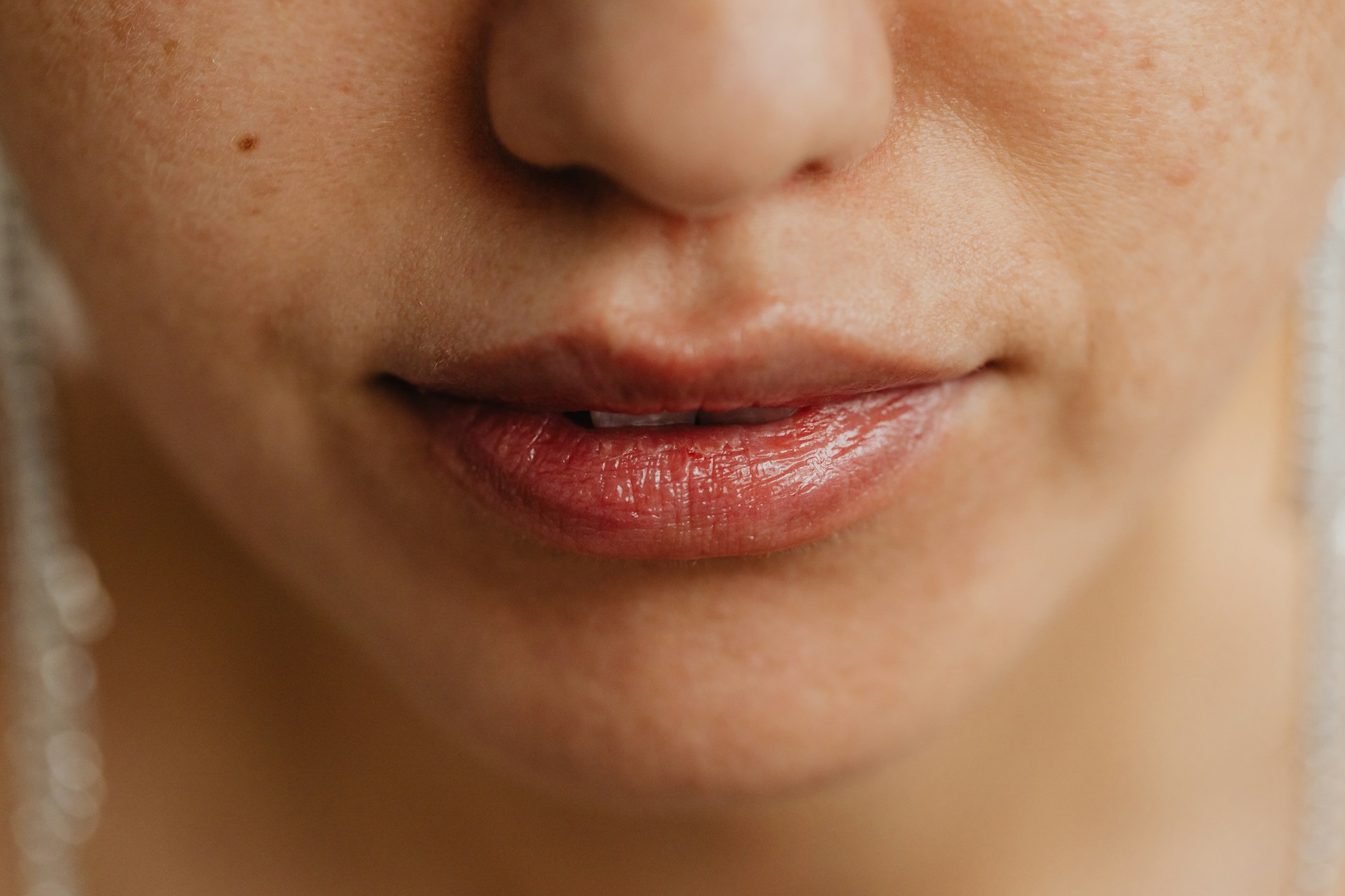 Herpes labial: Todo lo que debes saber