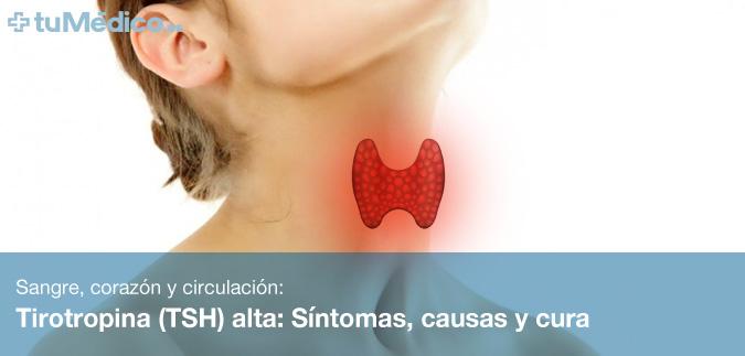 Hormona estimulante de la tiroides ultrasensible alta