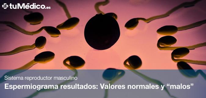 Espermiograma Resultados Valores Normales Y “malos”